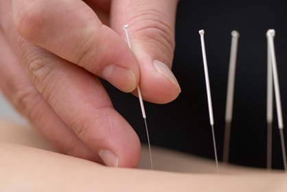 akupunktur chi harmonie ruswil